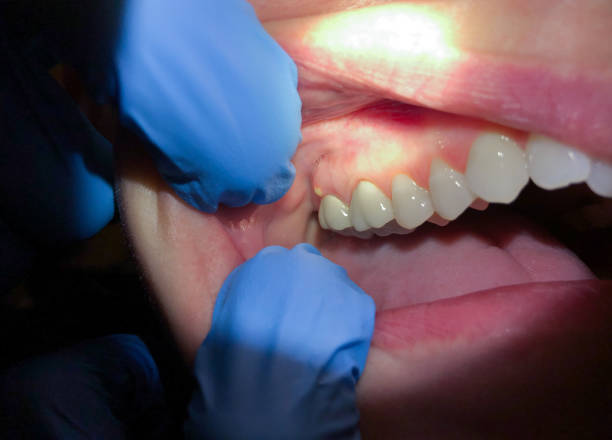 Best Emergency Dentist for Knocked-Out Tooth in Heber, UT